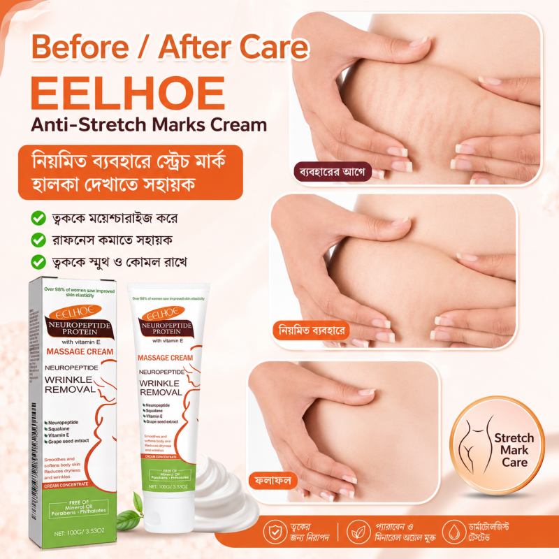 EELHOE Massage Cream (Anti-Stretch Marks) - Gallery Image